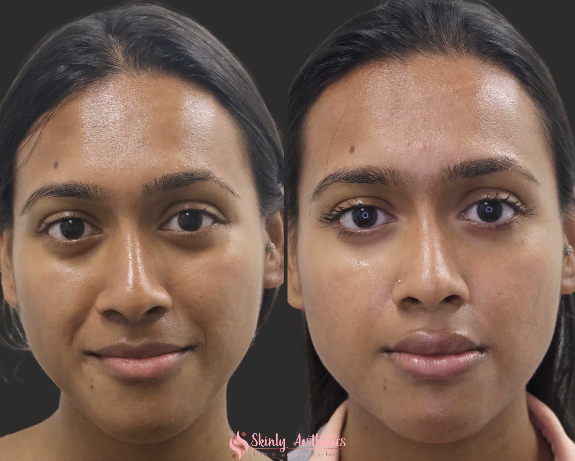 Effective Trust Restoration Techniques