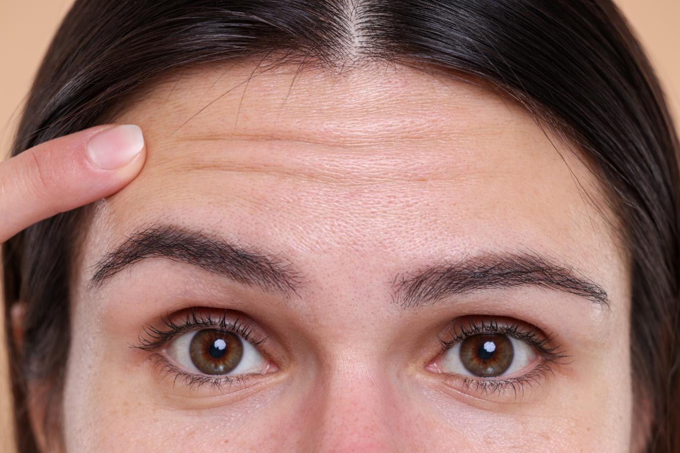 How to Get Rid of Forehead Wrinkles