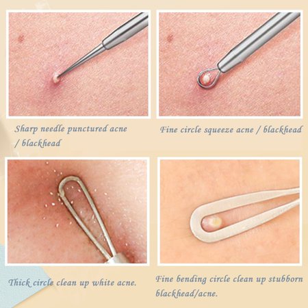 Tools for Safe Pimple Popping